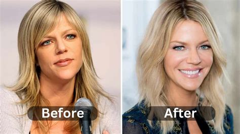 kaitlin olsen plastic surgery|Kaitlin Olson Body Measurements Height Weight Bra。